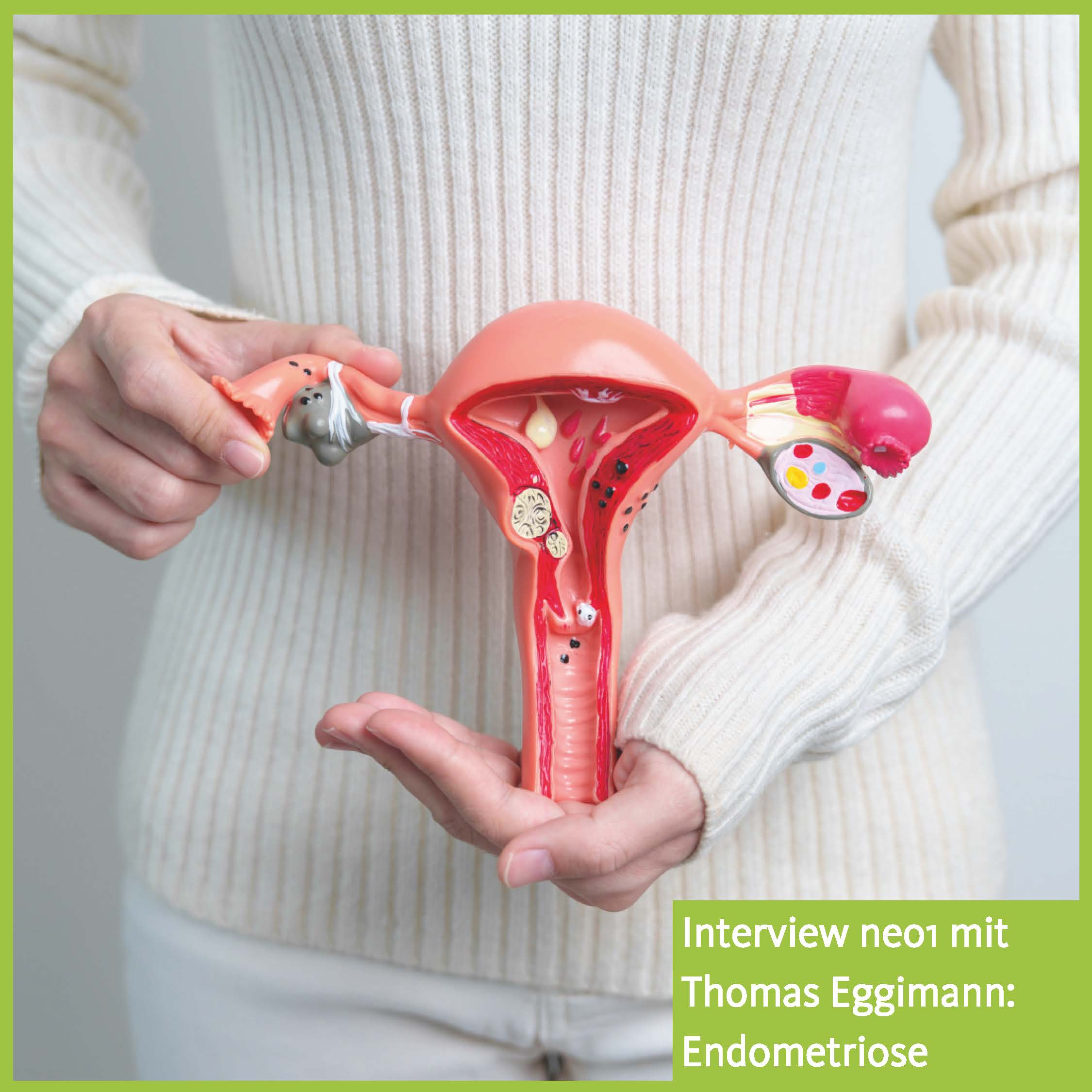 Endometriose Wochenthema neo1
