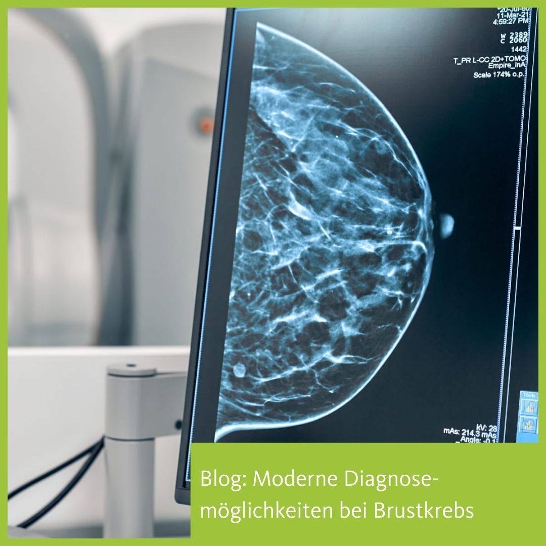GE_Mammotome Biopsie