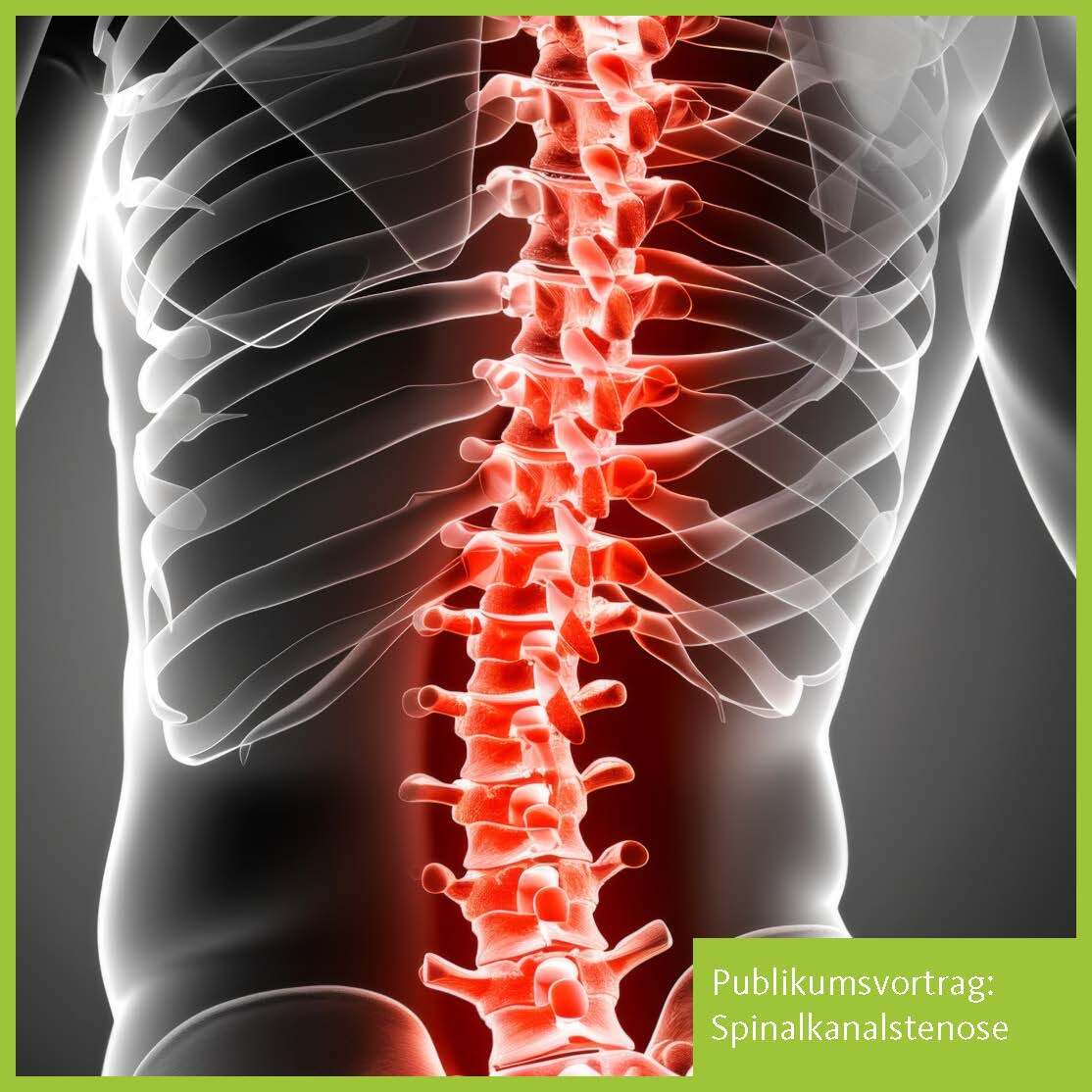 Publikumsvortrag Spinalkanalstenose_Insta_Rahmen2